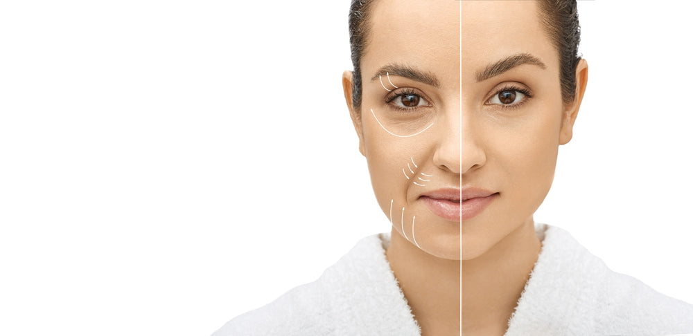 Before and after skin tightening treatment at Elite Med Spa